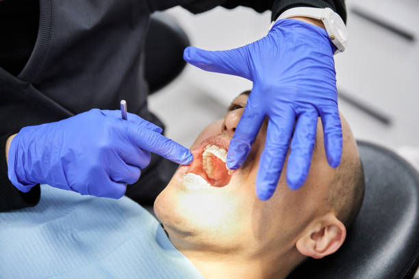 Best Emergency Gum Treatment in Louisa, KY